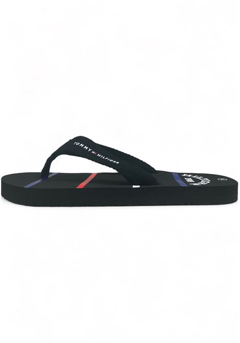  Tommy Hilfiger | T3B8334470058999999